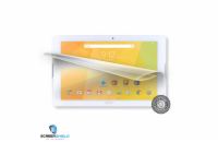 Screenshield™ Acer ICONIA One 10 B3-A20